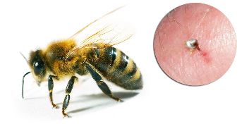 U sastav Hondrostrong ulazi pčelinji otrov, koji poboljšava metaboličke procese u tkivima