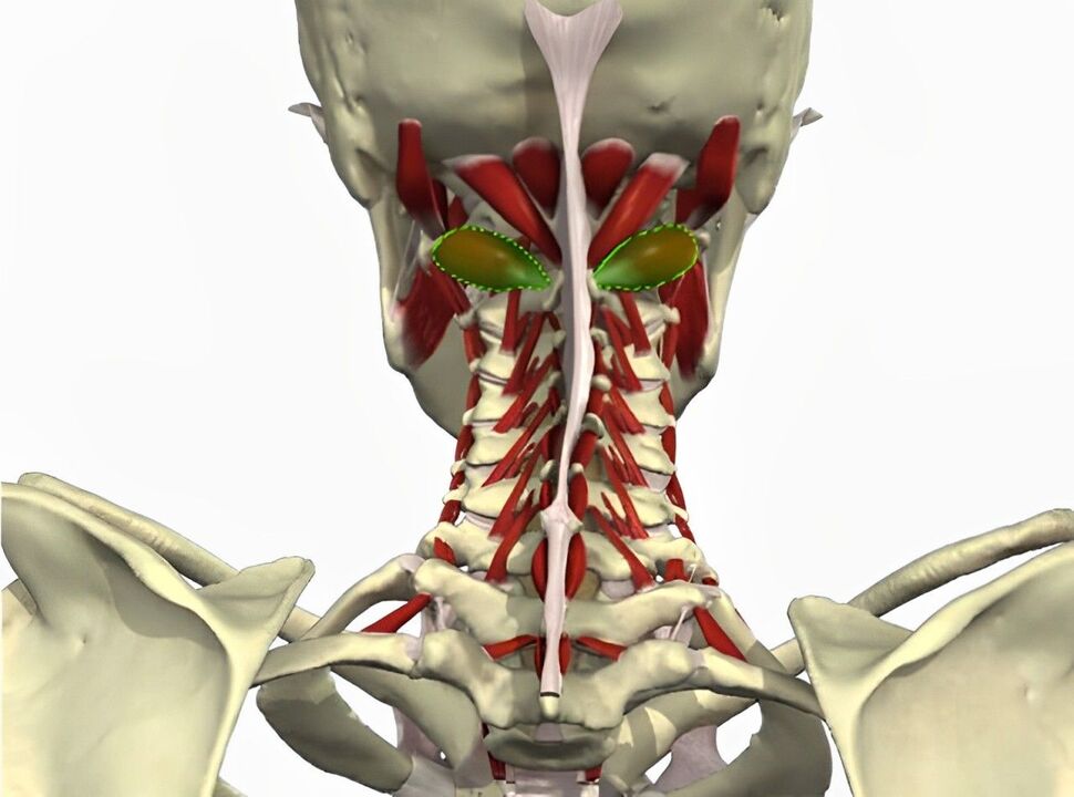 sindrom vertebralne arterije